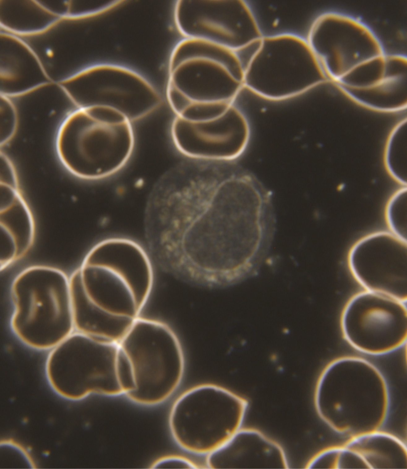 LGL-Lymphozyt1