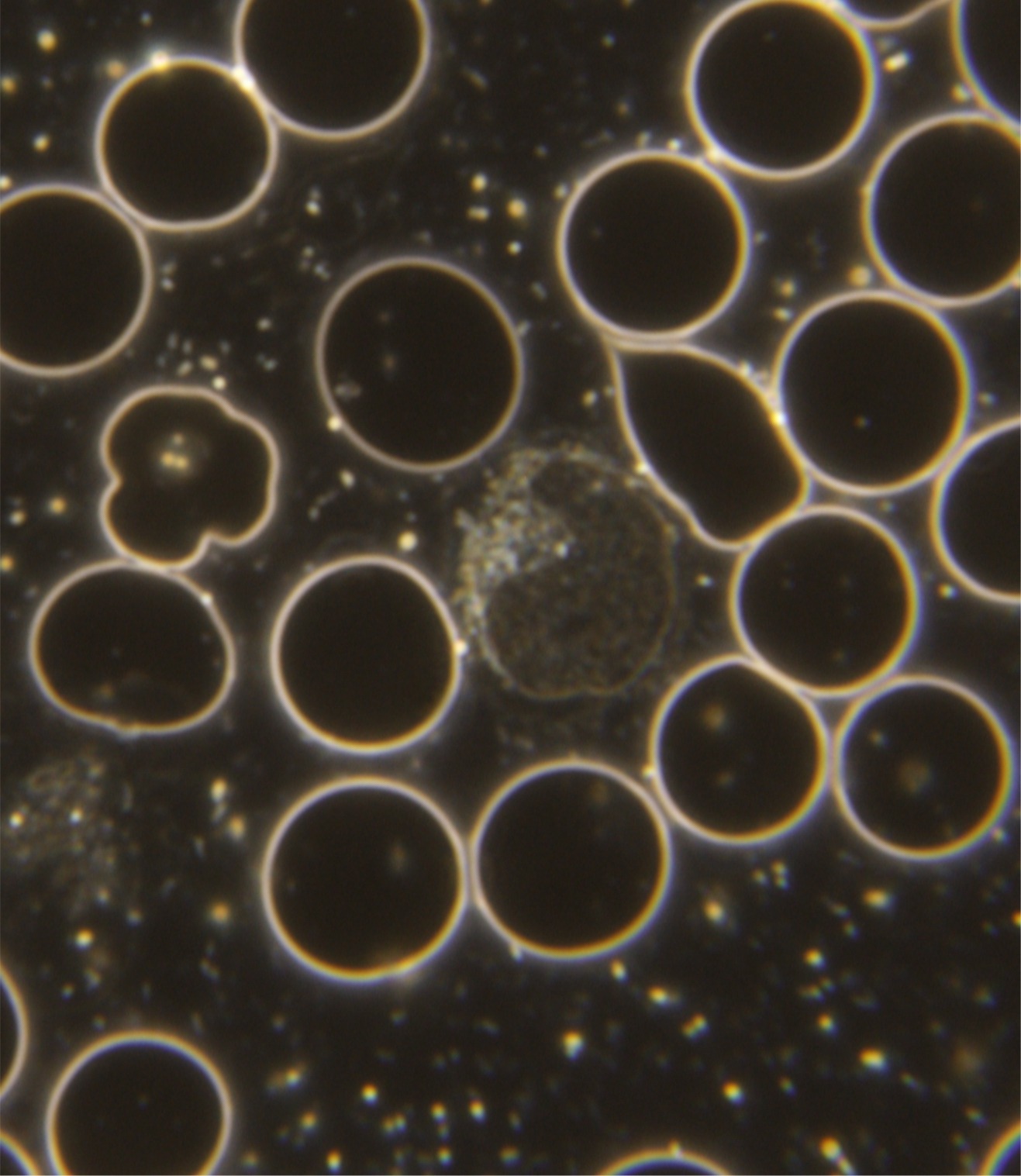 normaler Lymphozyt